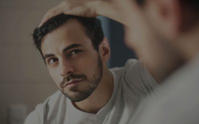 Male Pattern Baldness–Which Treatments Actually Work?