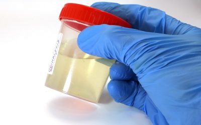 Bactrim for Urinary Tract Infection – How Resistant Are Bacteria to It?