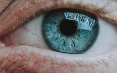 Chalazion vs Hordeolum (Stye)