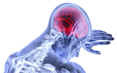 Post-Herpetic Neuralgia Treatment