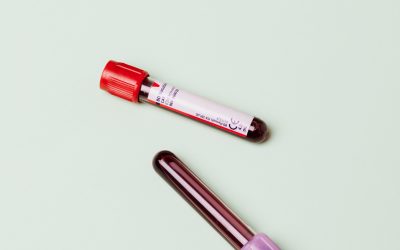 What Are Thyroid Function Tests?