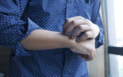 Do I Have Scabies?